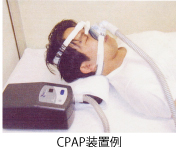 CPAP